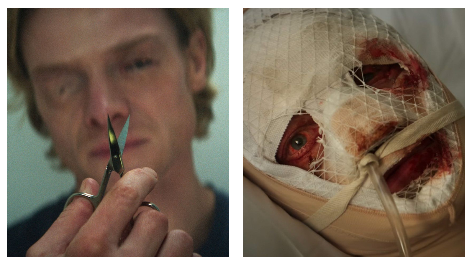 Two-panel image featuring Tom Rhys Harries as Matt Hagen: On the left, a close-up shows him holding up small scissors with a focused expression. On the right, his face is tightly wrapped in medical gauze and netting, with one bloodshot eye and lips exposed around a breathing tube.